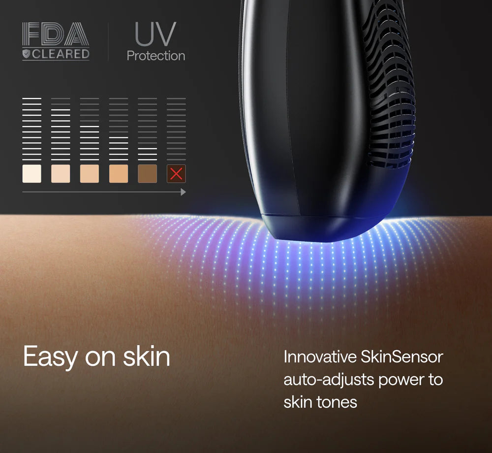 Ulike X - Men's IPL Hair Removal Device
