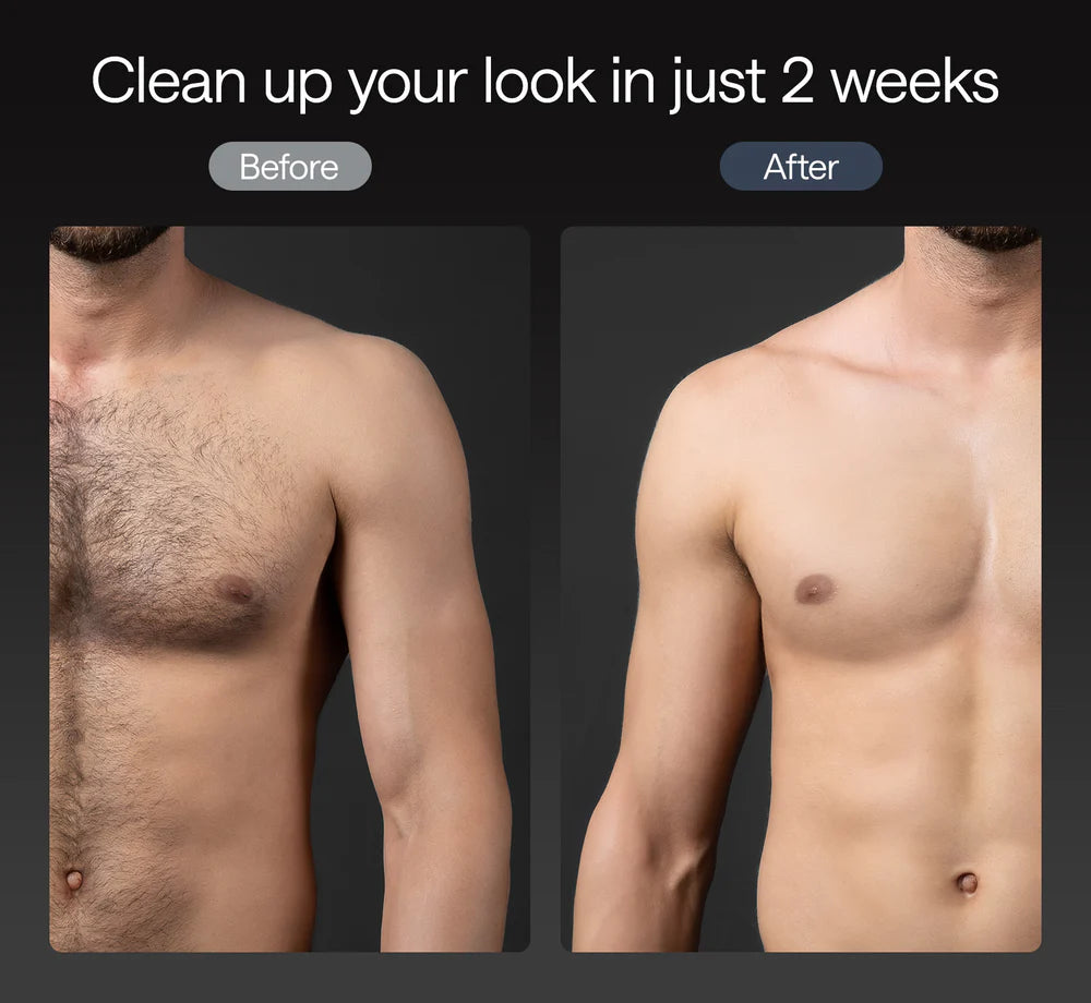 Ulike X - Men's IPL Hair Removal Device