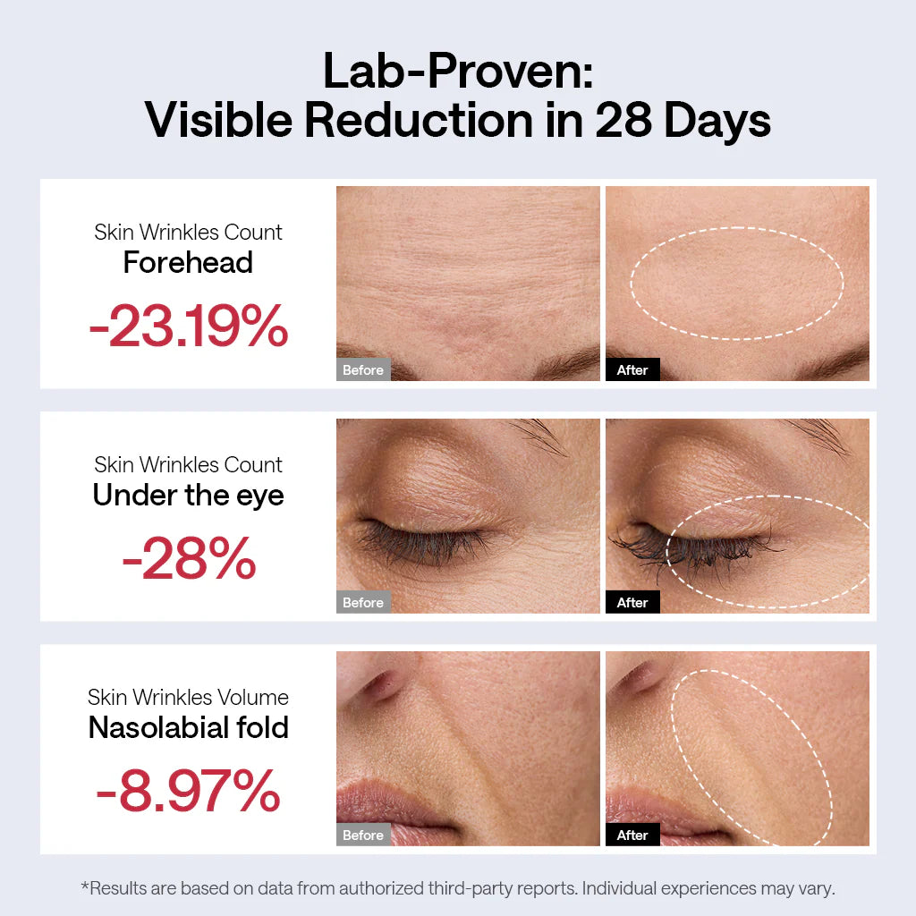 JMOON NouvelleSkin Facial Toning Device