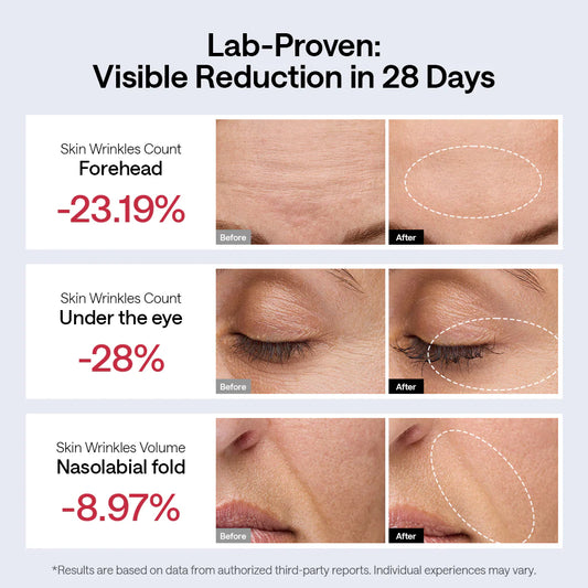 JMOON NouvelleSkin Facial Toning Device