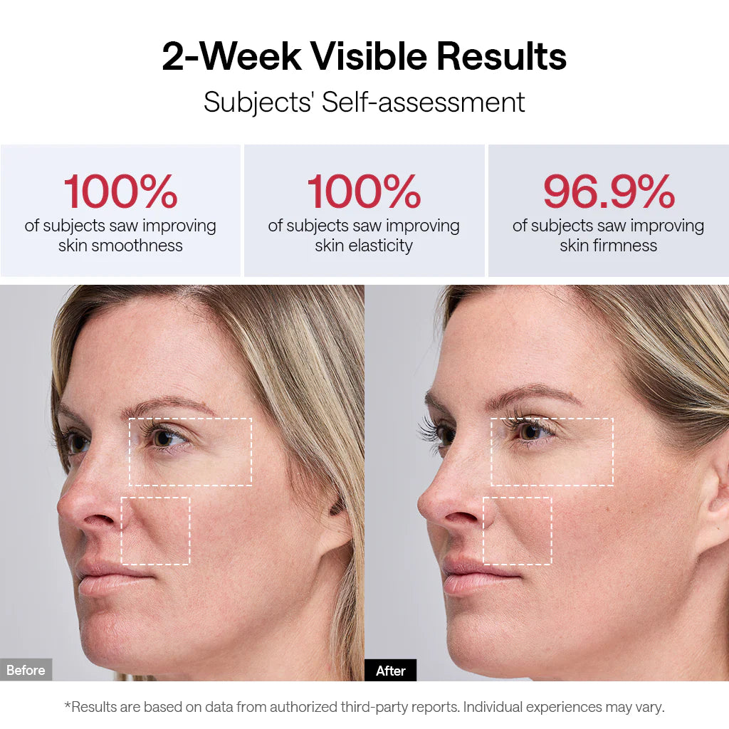 JMOON NouvelleSkin Facial Toning Device